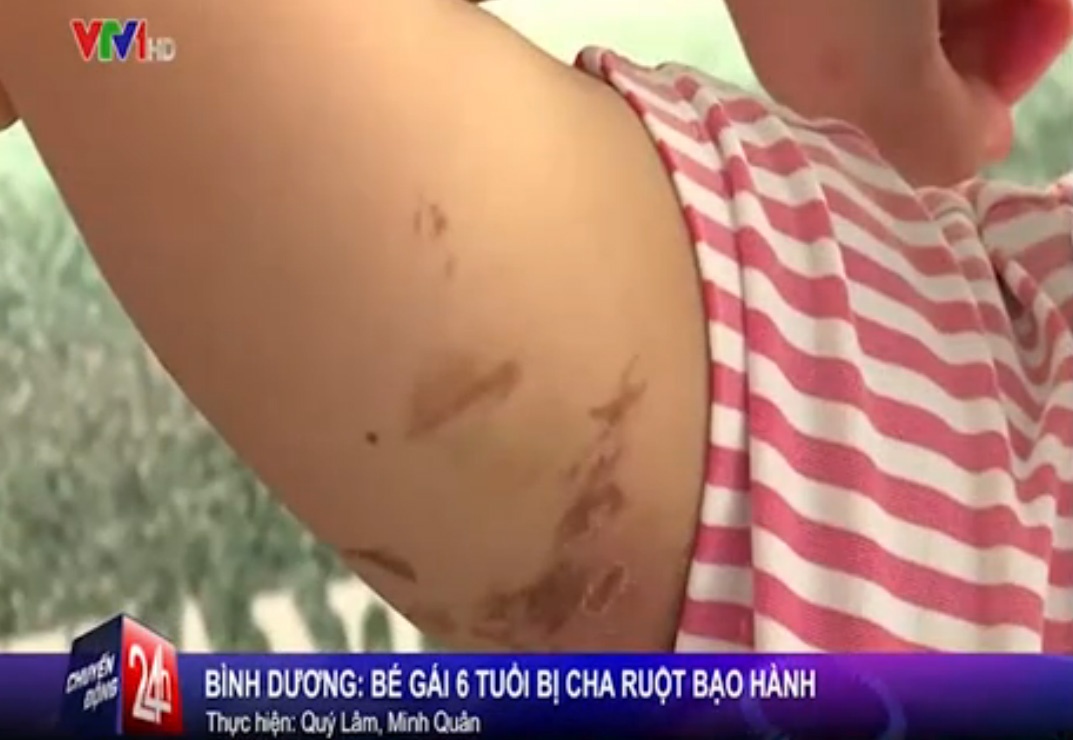 VTV: Be gai 6 tuoi bi cha ruot dung lua dot khap nguoi hinh anh