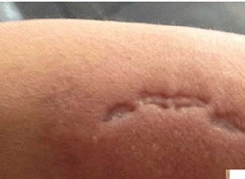 Mau thuan ban gai, ra phuong danh, can cong an hinh anh