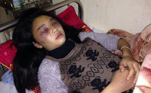 Dua nu sinh vao khach san roi danh hoi dong da man hinh anh