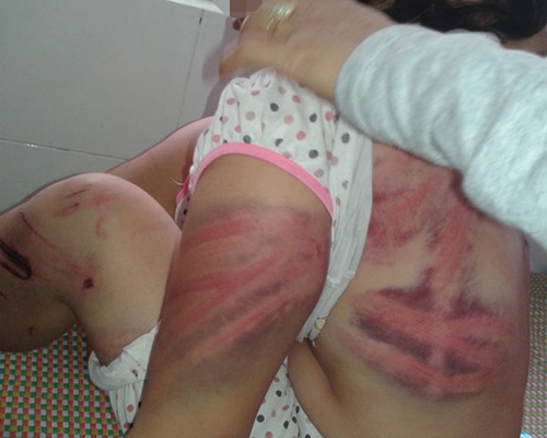 Tra tan vo da man nhu thoi trung co hinh anh