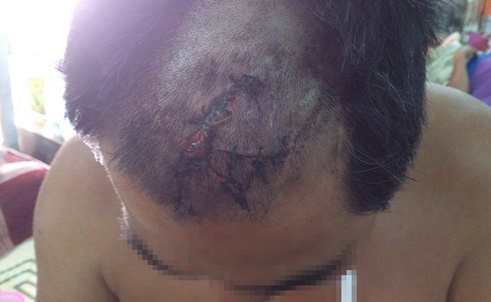 Khach den 'vui ve' bi chu quan danh trong thuong? hinh anh