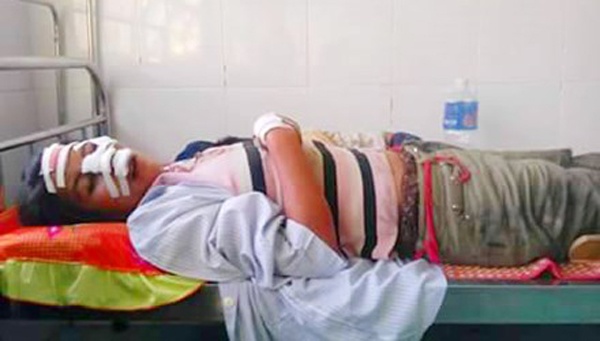 Lat xe cong nong, 2 nguoi chet, 9 bi thuong hinh anh