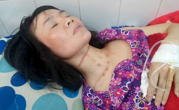 Khi em nuoi lo mat ke cuop hinh anh