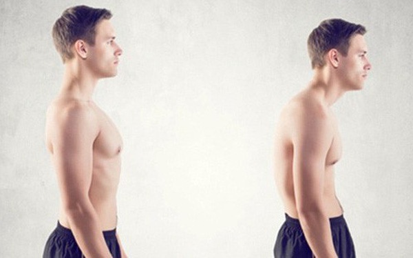 Gu lung - can benh kinh nien cua dan van phong hinh anh