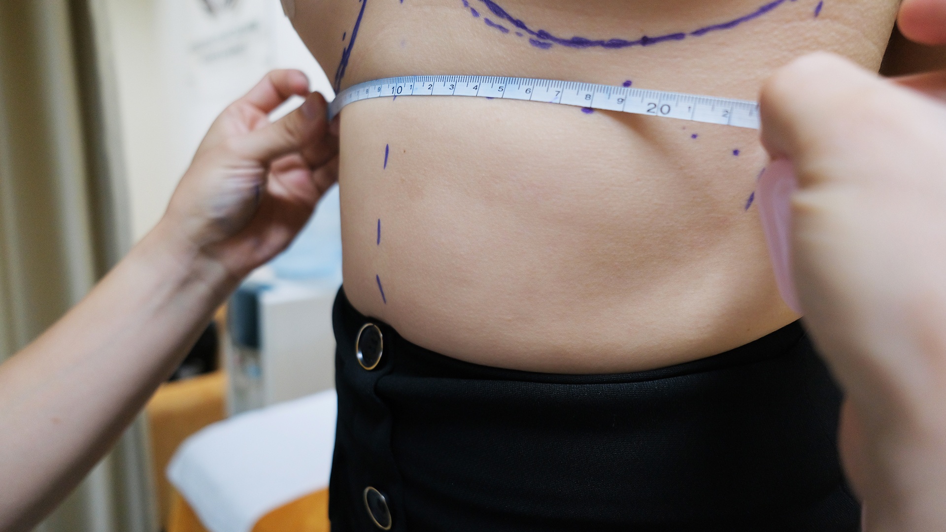 quy trinh nang nguc anh 3