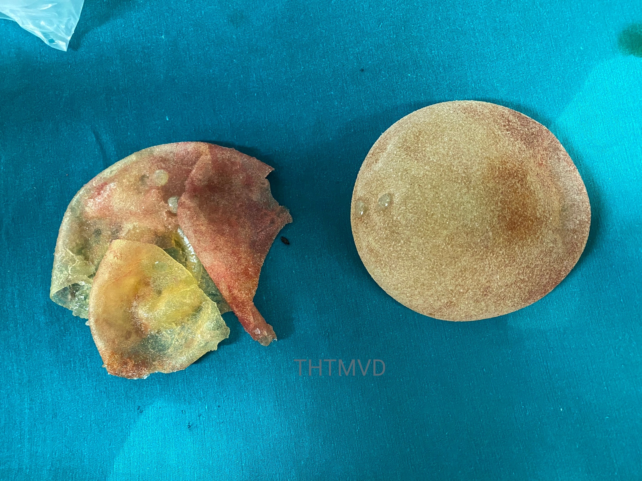 vo tui nguc nham to, anh 1