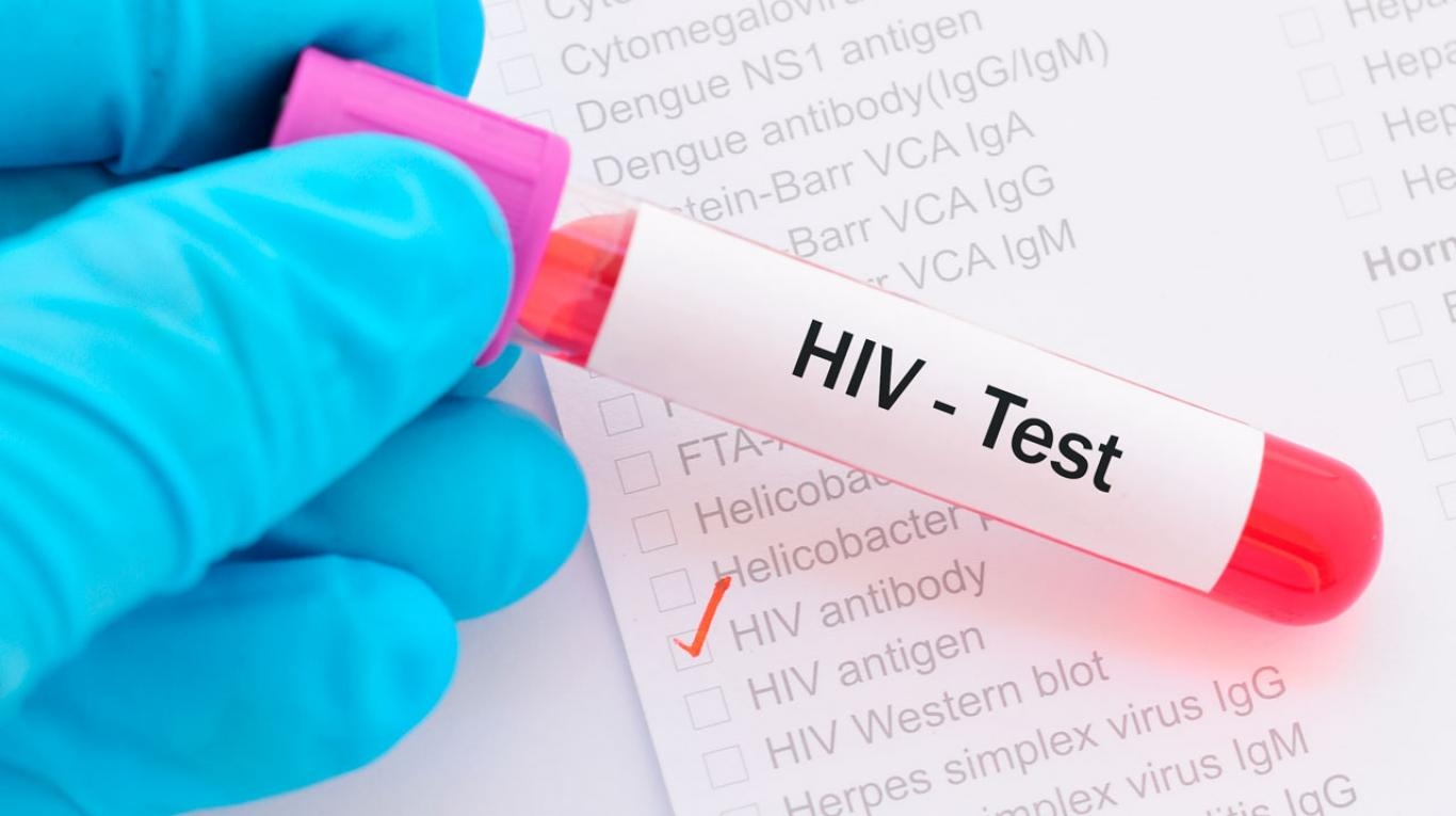 Viet Nam dat muc tieu cham dut dich AIDS vao nam 2030 hinh anh