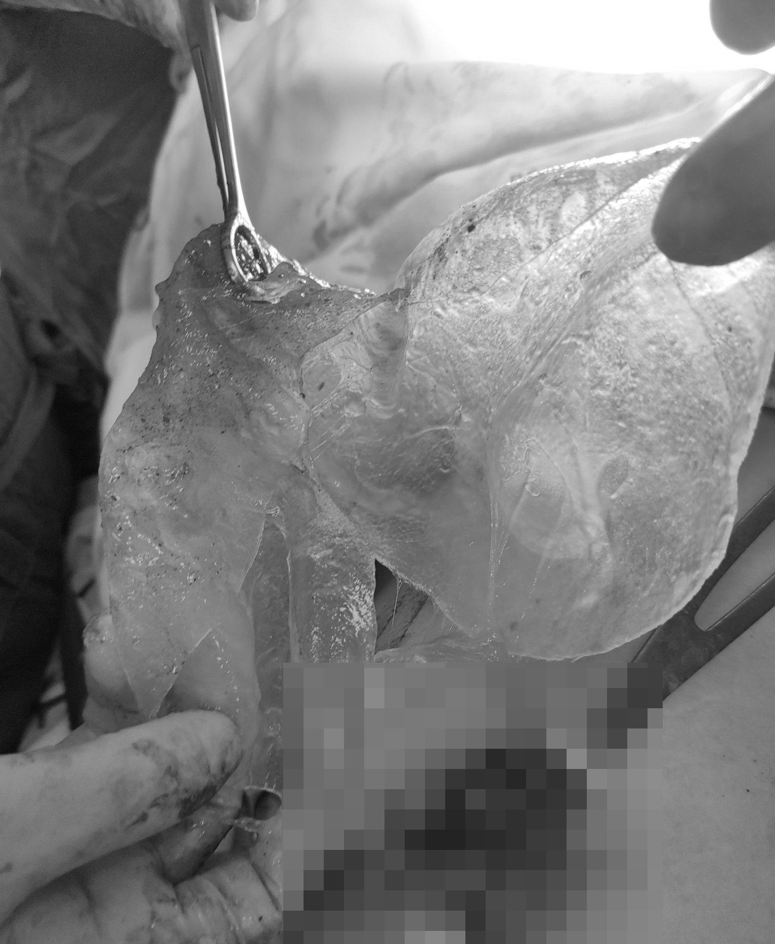 u vu sau khi vo tui silicon anh 1