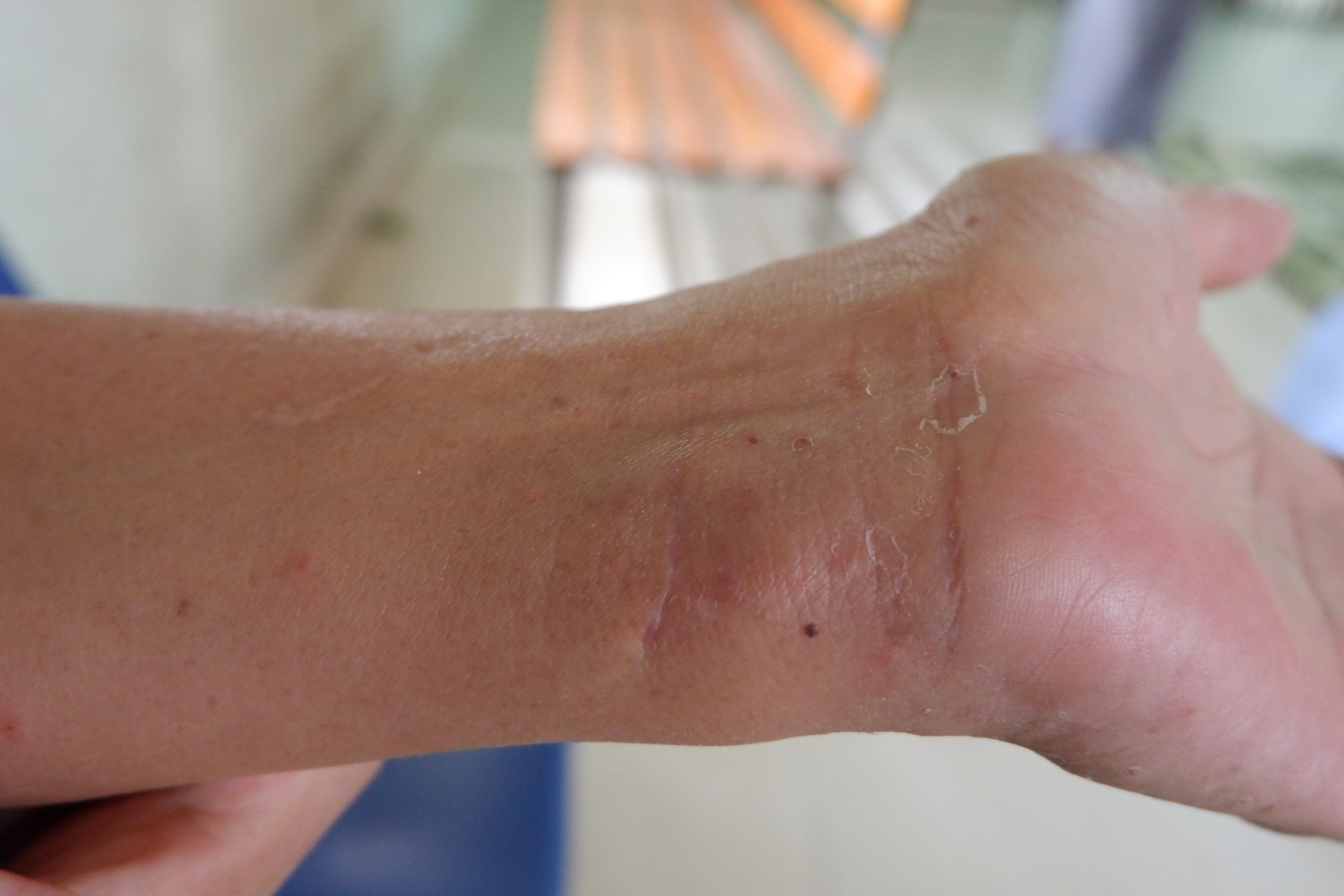 benh nhan tu sat 3 lan anh 2