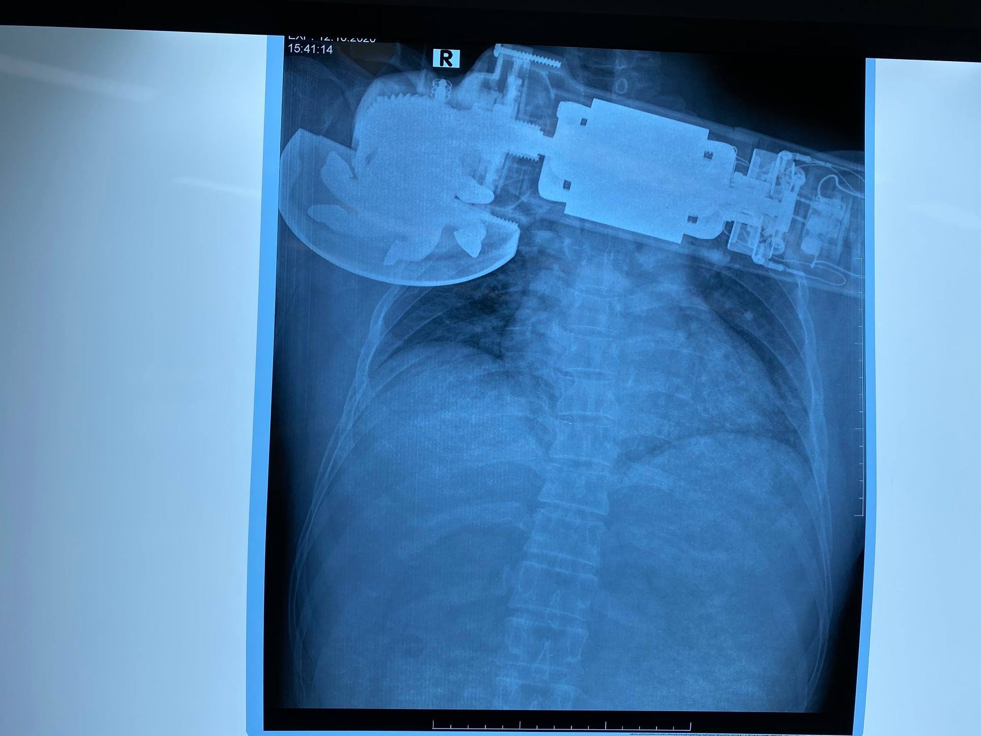 may cha vang vao nguoi anh 1