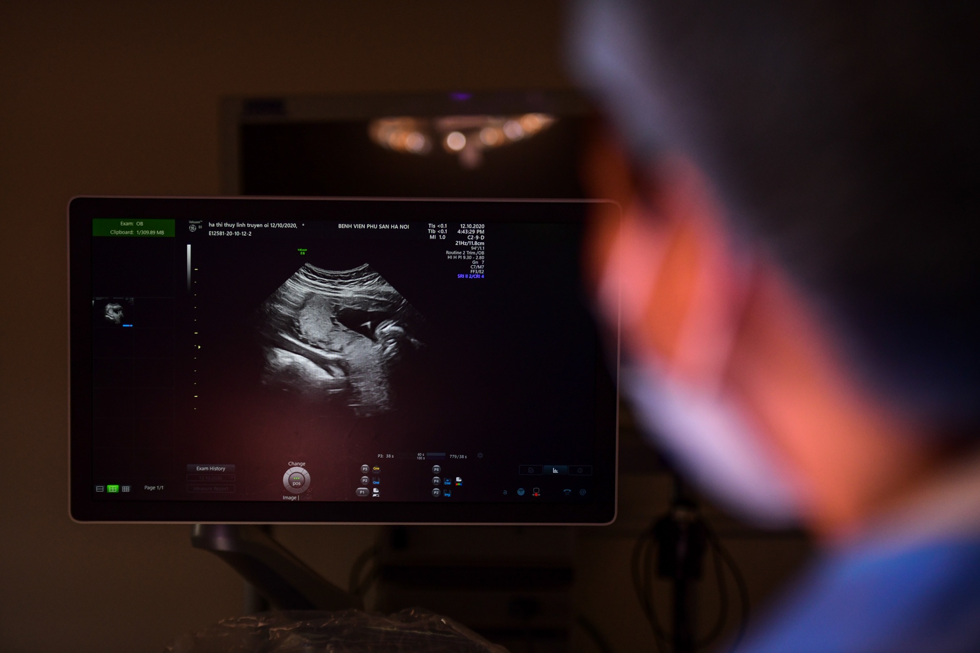 Bac si cuu thai nhi con nam trong bung me hinh anh