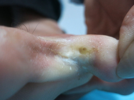 nguy co mac benh da lieu vung lu anh 3