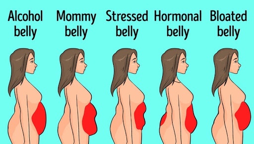 phân loại béo bụng ảnh 1 phan loai beo bung anh 1