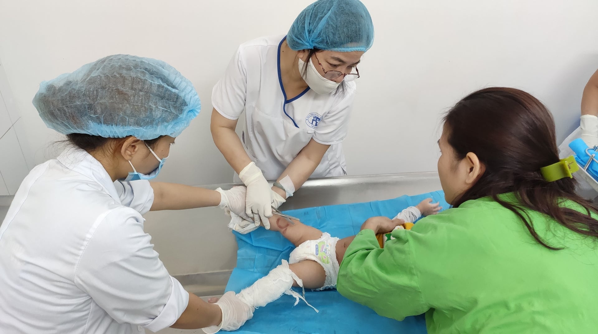 Be 7 thang tuoi bi bong vi cham vao binh u sua hinh anh