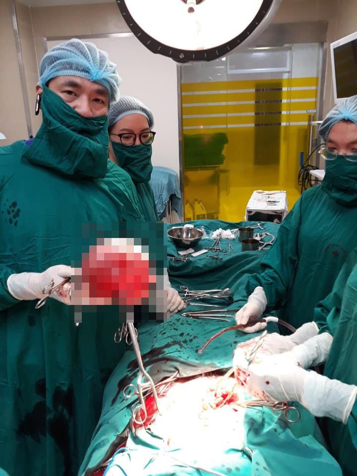 khối u khổng lồ như mang thai ảnh 1 khoi u khong lo nhu mang thai anh 1