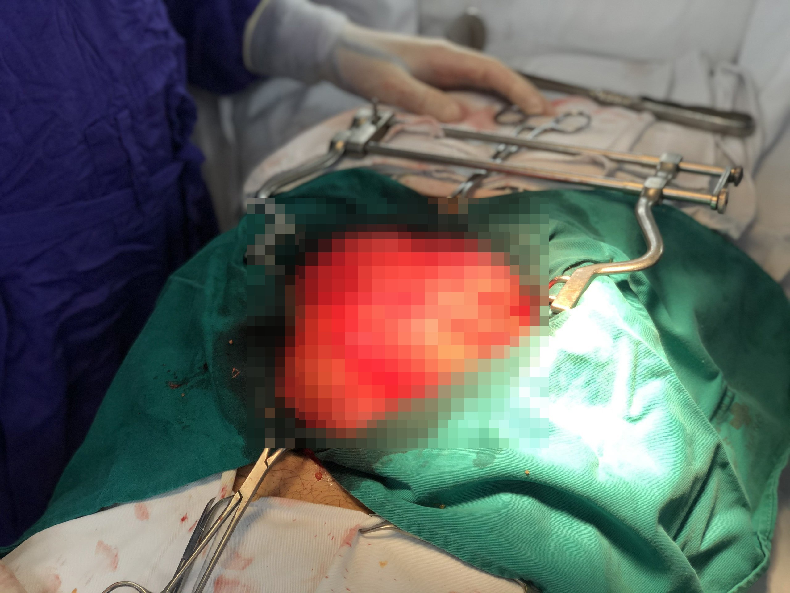 tai phat ung thu anh 1