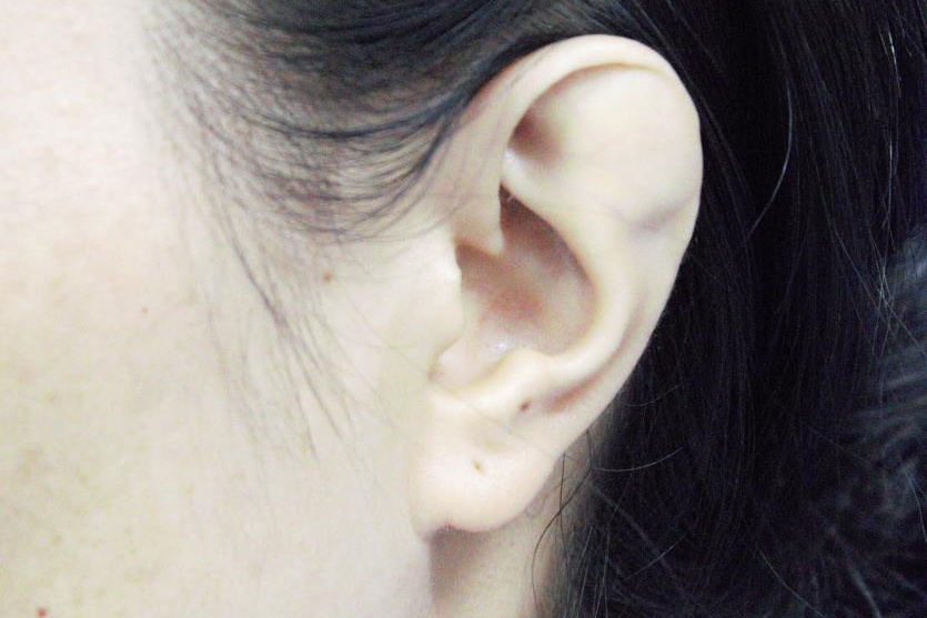 Nguoi phu nu giau chong ve doi tai di tat  suot 15 nam hinh anh