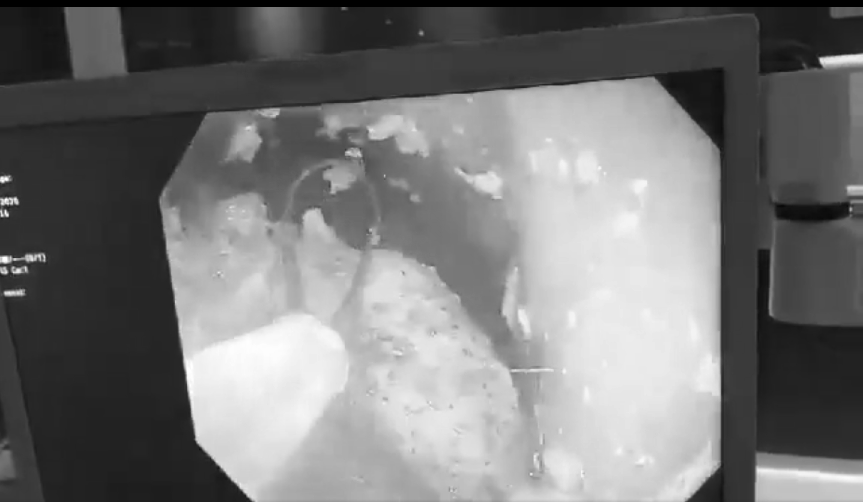 tac da day vi ba thuc an anh 1