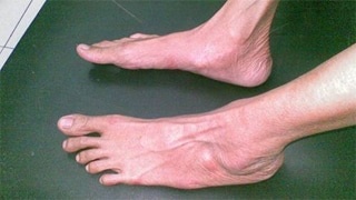 Be trai 11 tuoi cao 1,8 m hinh anh