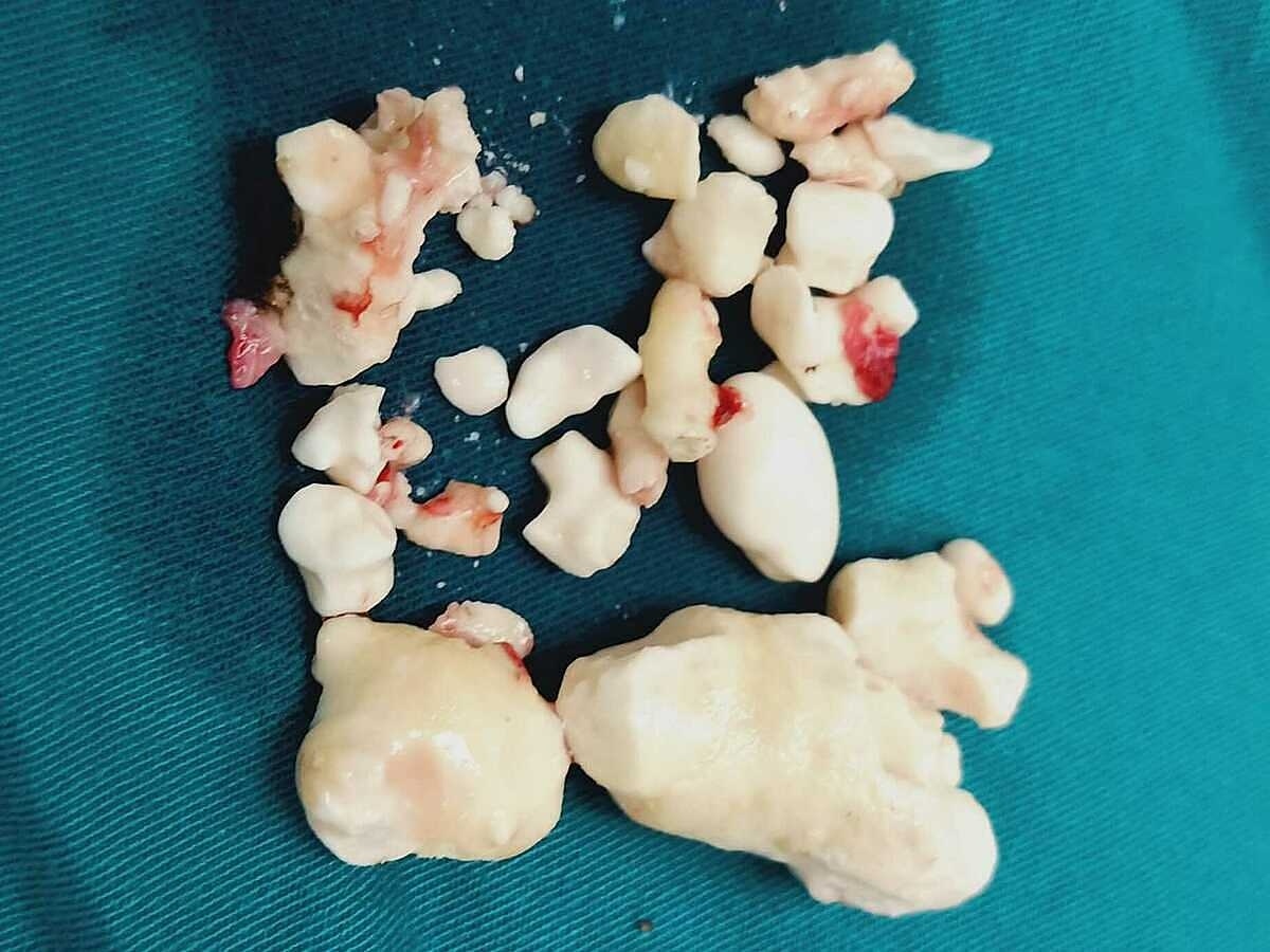 nguy co do nghien ruou anh 1