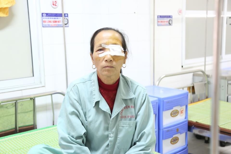 Nguoi phu nu co mong mat che kin dong tu hinh anh