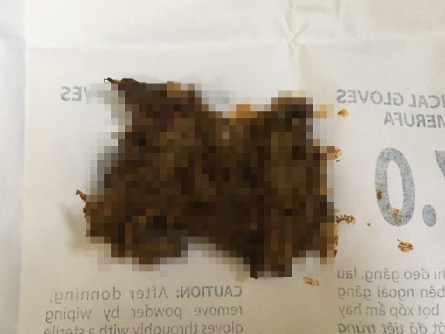 tre tac ruot vi an vat anh 1