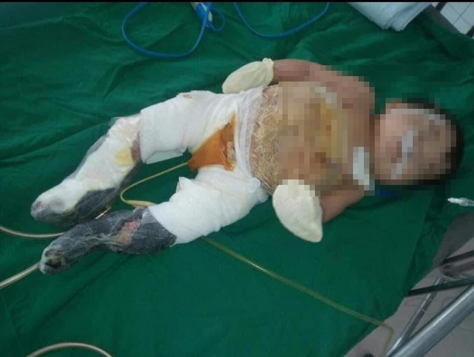 benh nhi bong than anh 1