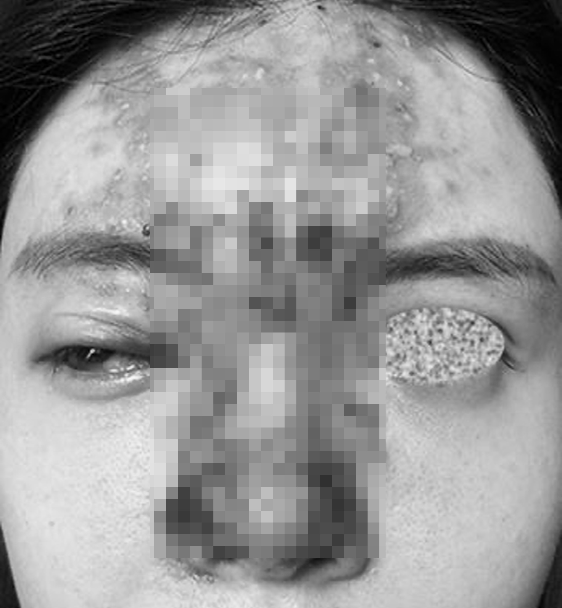 nhiem trung do nang mui anh 1