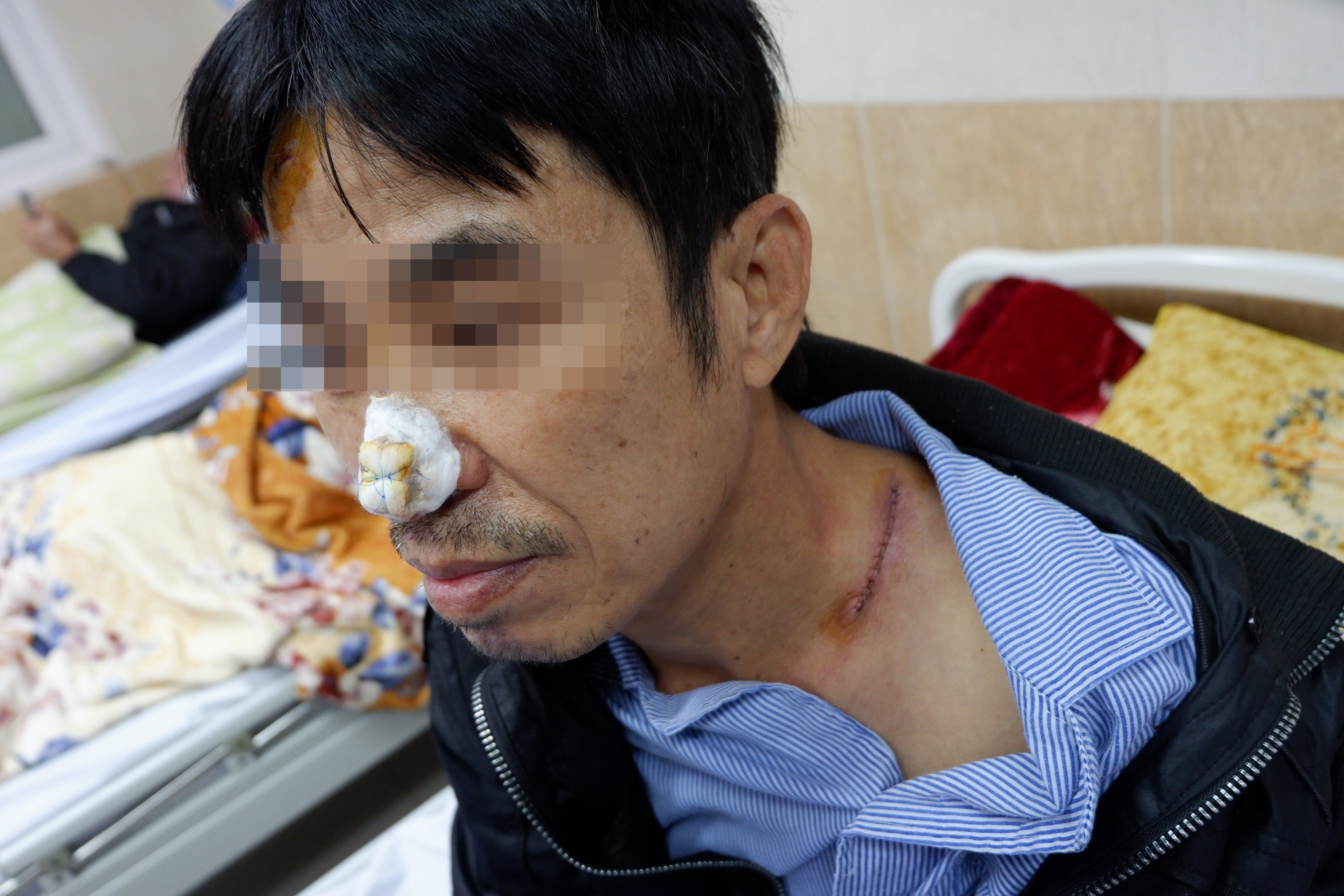 chó becgie cắn người ảnh 1 cho becgie can nguoi anh 1
