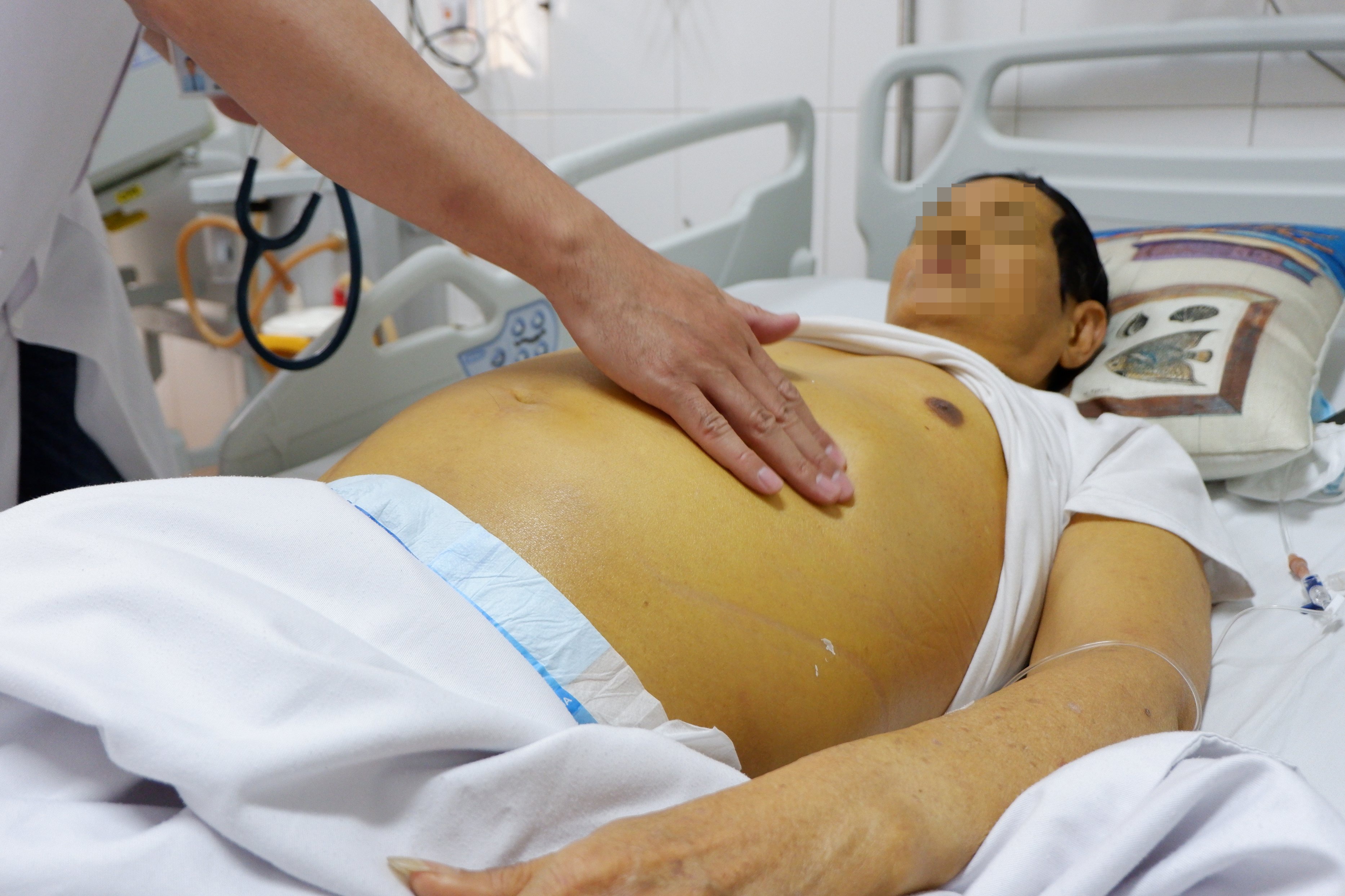 viem gan B co khoi duoc khong anh 1