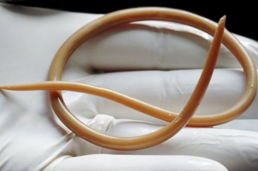 tre nhiem giun dua anh 1