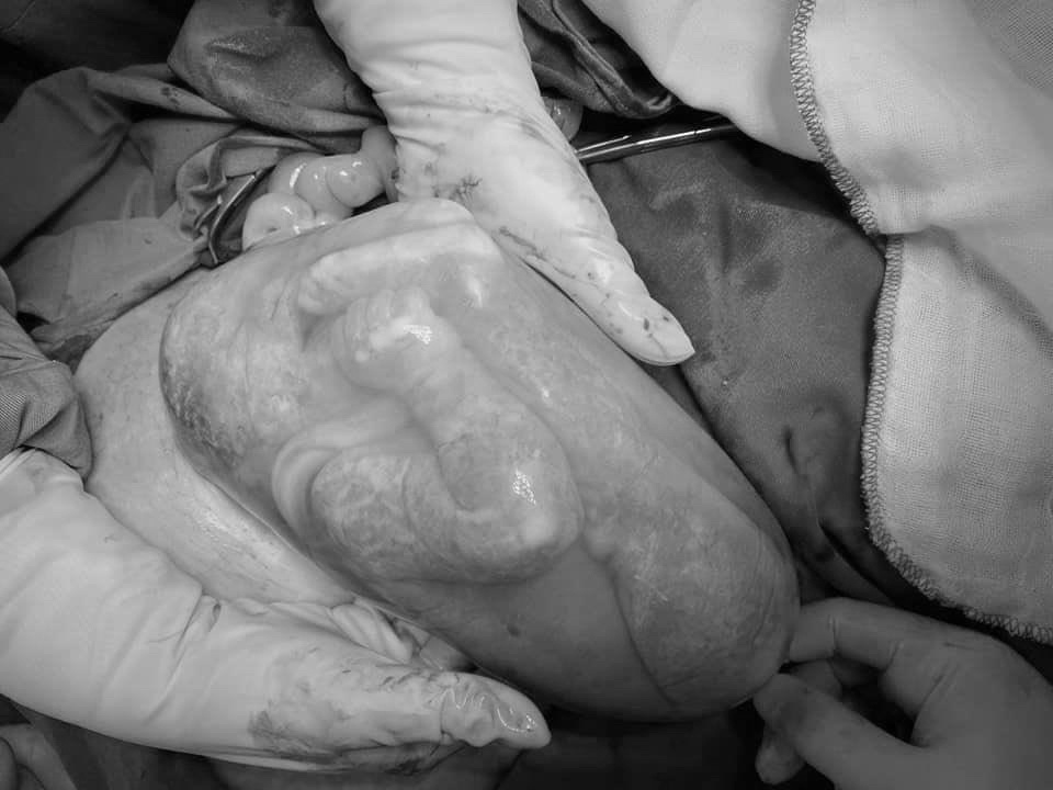 tre con trong boc oi anh 1