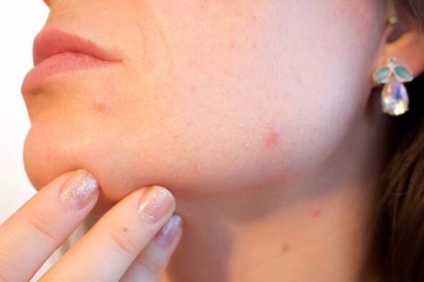 Nguoi da mun co nen su dung kem chong nang? hinh anh