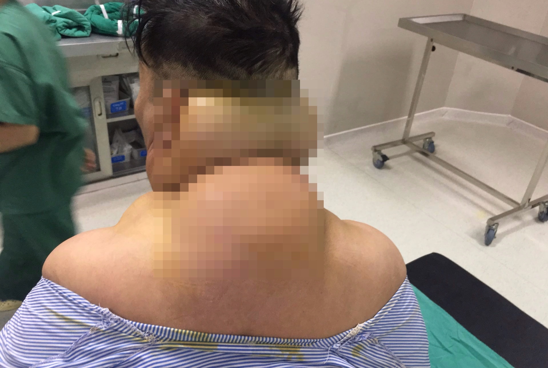 Nguoi dan ong bi bien dang co the do uong nhieu ruou hinh anh