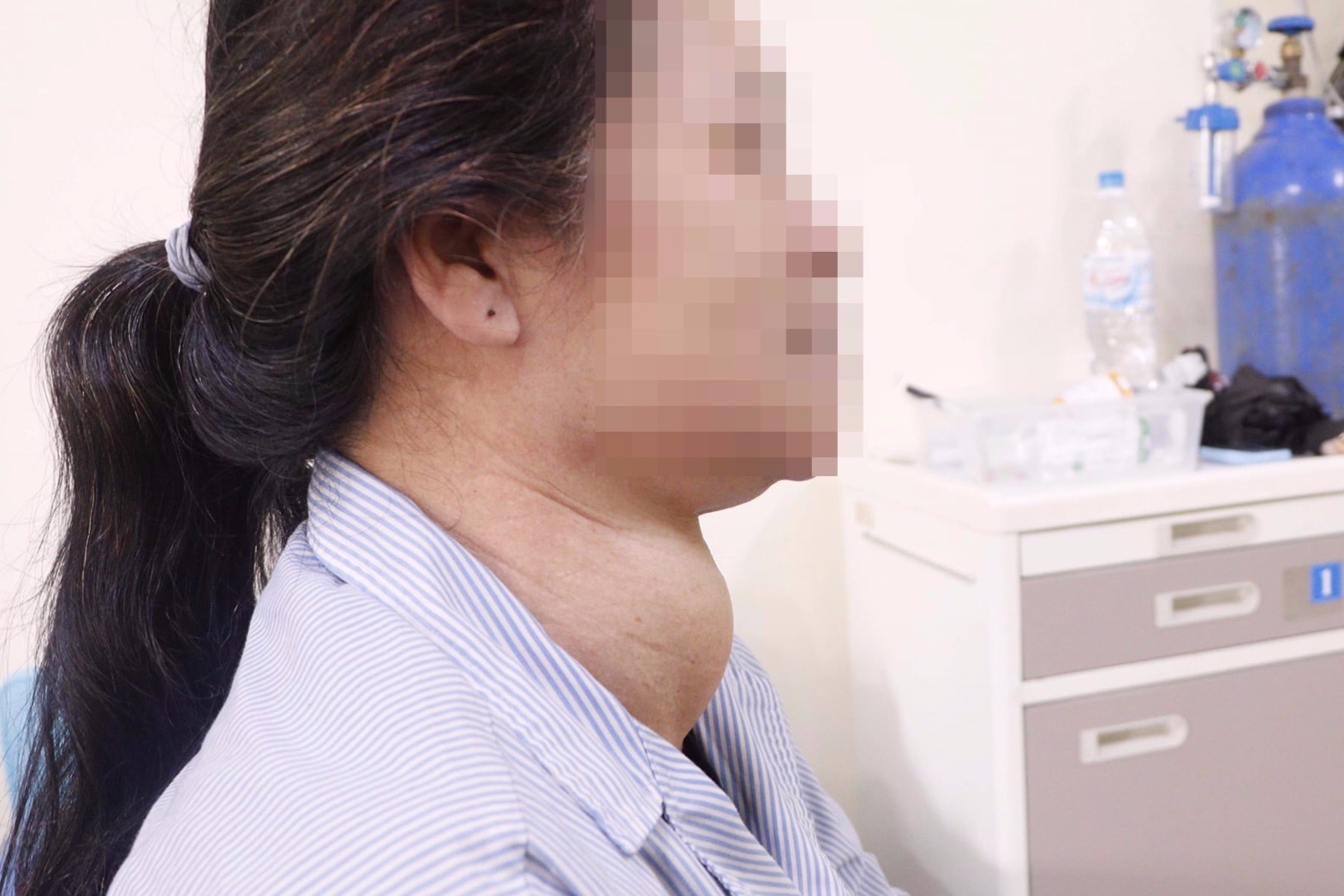 Nguoi phu nu mang khoi u khong lo o co hinh anh