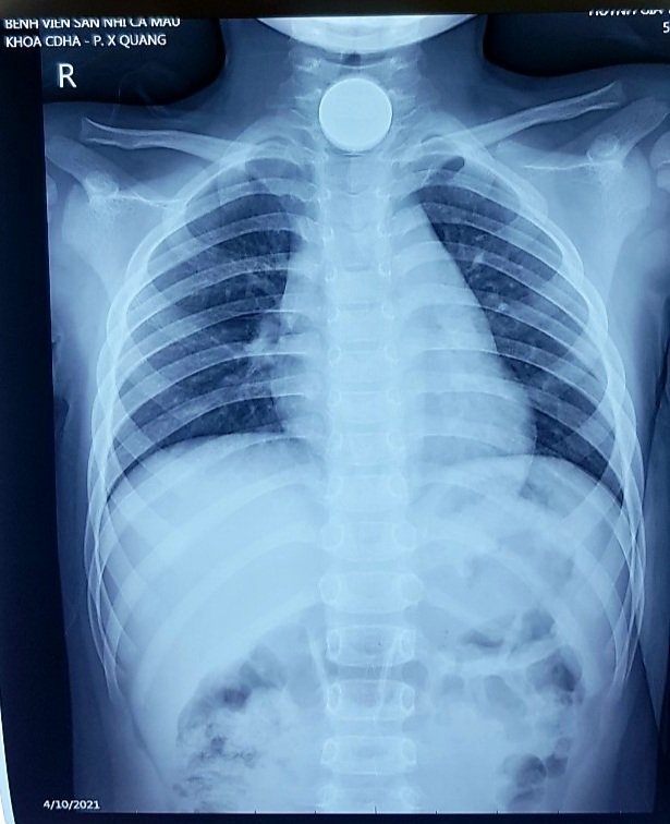 nuot phai dong xu anh 1