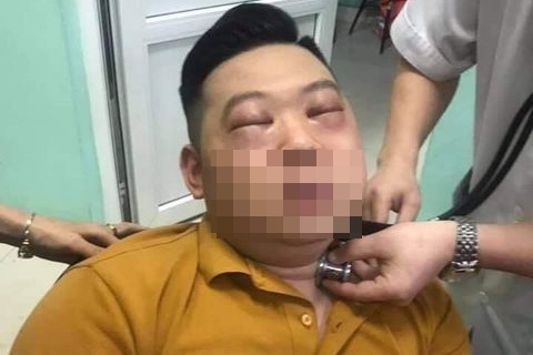 Nam thanh nien o Phu Tho bi soc phan ve do thai hanh hinh anh