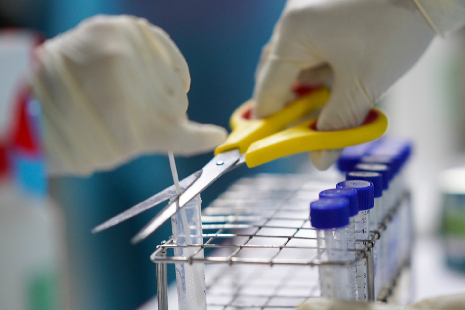 tinh hinh dich covid-19 anh 1