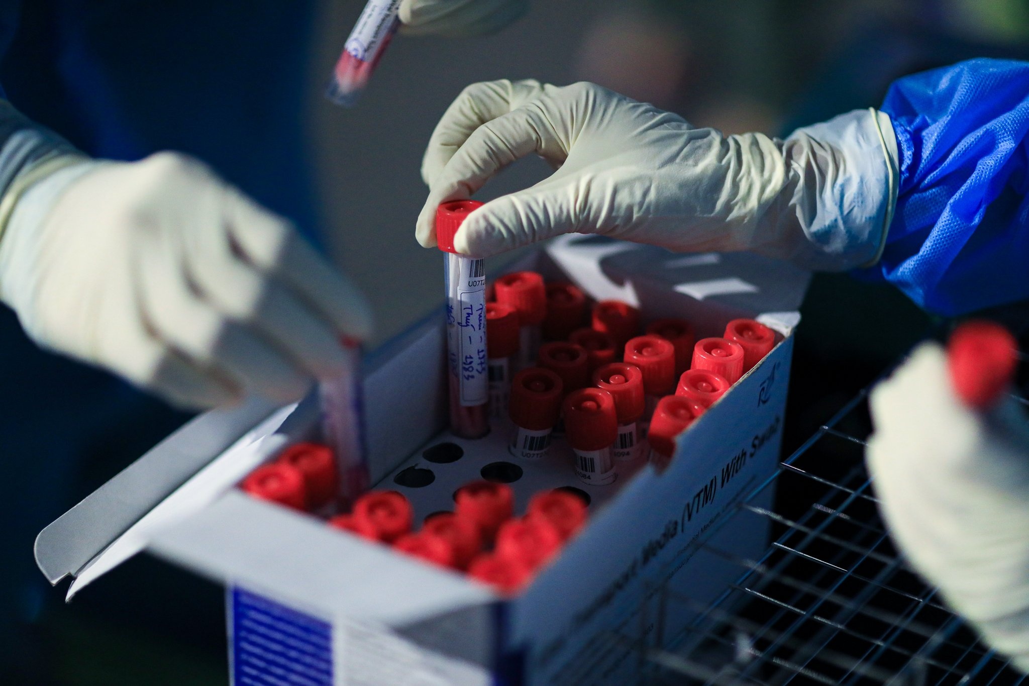 dich covid-19 tai TP.HCM anh 1