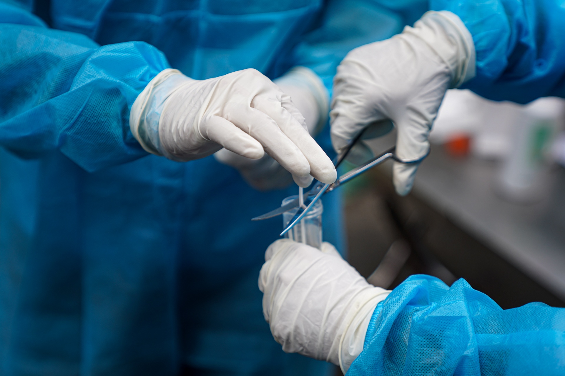 Them 80 benh nhan Covid-19 tu vong trong 10 ngay hinh anh