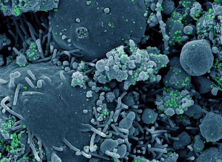 Hy vong moi trong nghien cuu thuoc dieu tri Covid-19 hinh anh