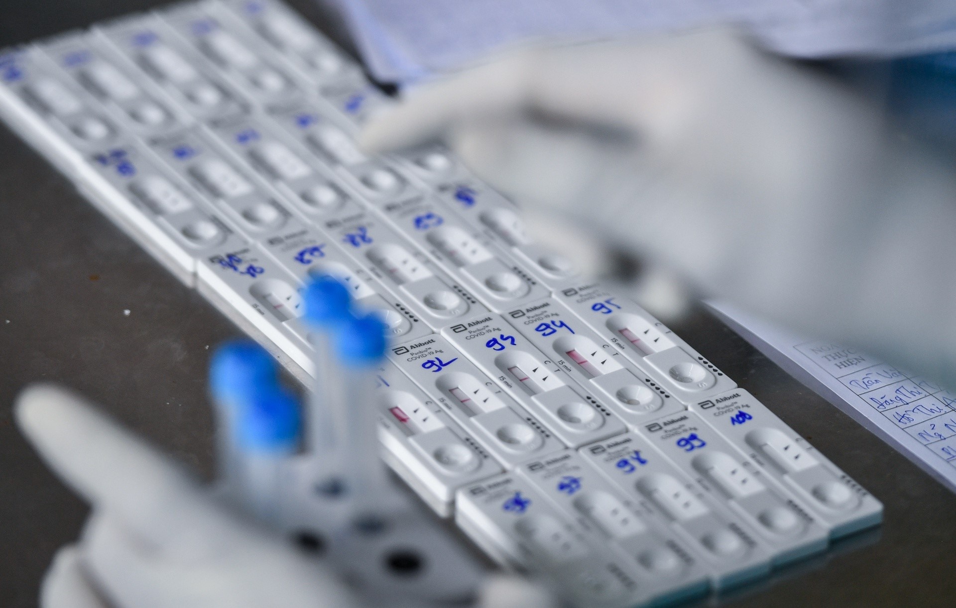 chi phi xet nghiem covid-19 anh 1