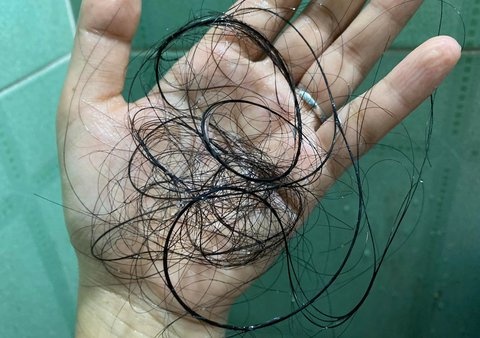 di chung hau covid-19 anh 1