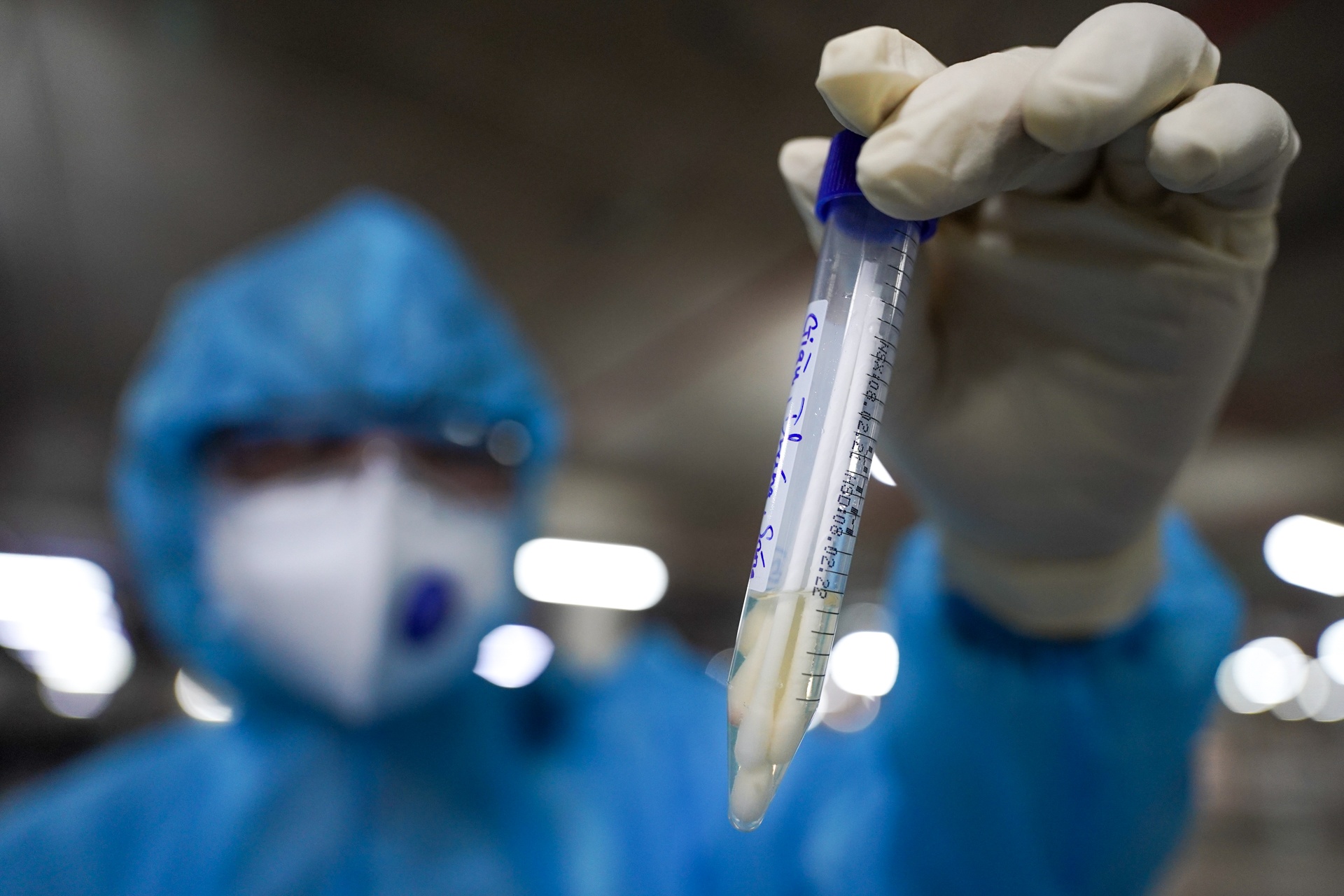 Khoi Covid-19, F0 van co nguy co tai nhiem bien chung moi hinh anh