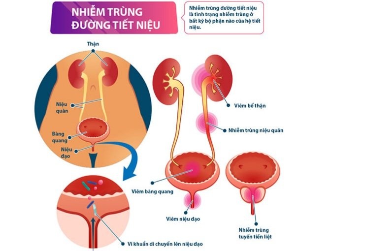 benh phu nu o dan ong anh 3