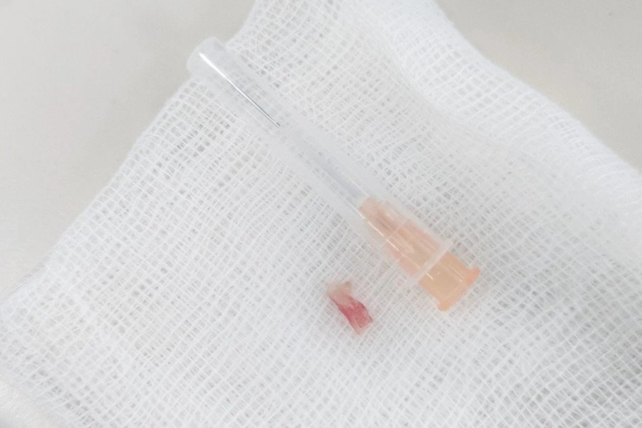 tre hoc thit tom anh 1