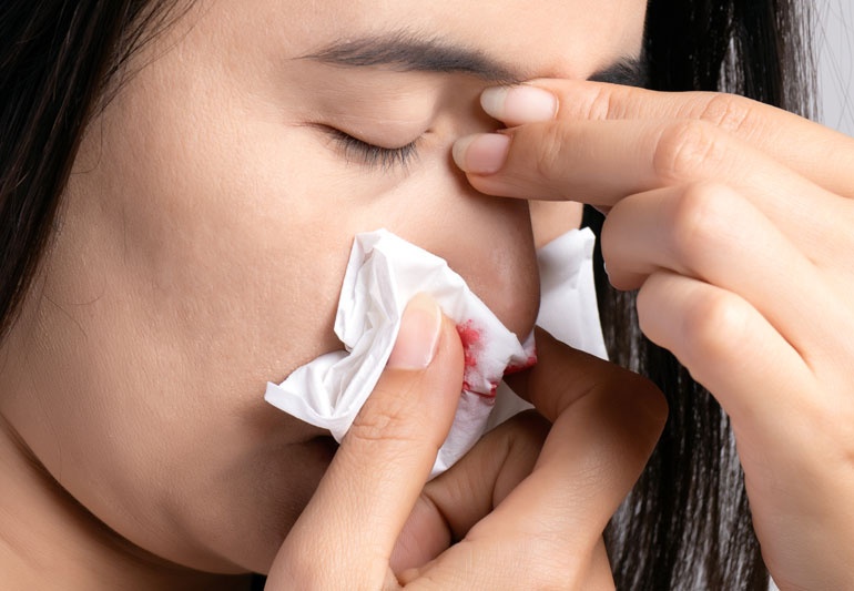 Nguoi phu nu mac ung thu da sau khi xuat hien not san duoi canh mui hinh anh