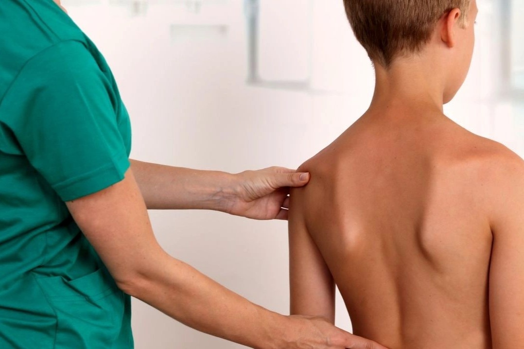 Be trai 6 tuoi co nguy co khong the ngoi vao ban hoc do veo cot song hinh anh