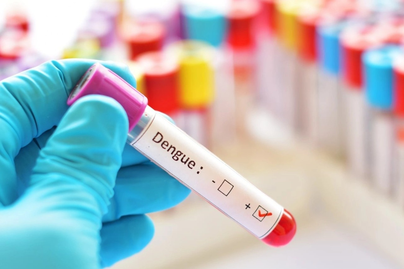 Dinh dich sot xuat huyet tai Ha Noi co the keo dai trong thang 10, 11 hinh anh