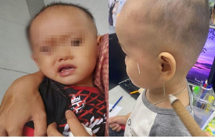 tre liet mat vi quat anh 1